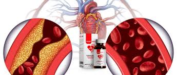Cardio NRJ -für Bluthochdruck - Aktion - kaufen - Bewertung