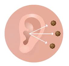 Earoptim Patches - lepší sluch – účinky – cena – kde koupit