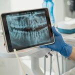 Preparing for Your CBCT Test A Step-by-Step Guide 