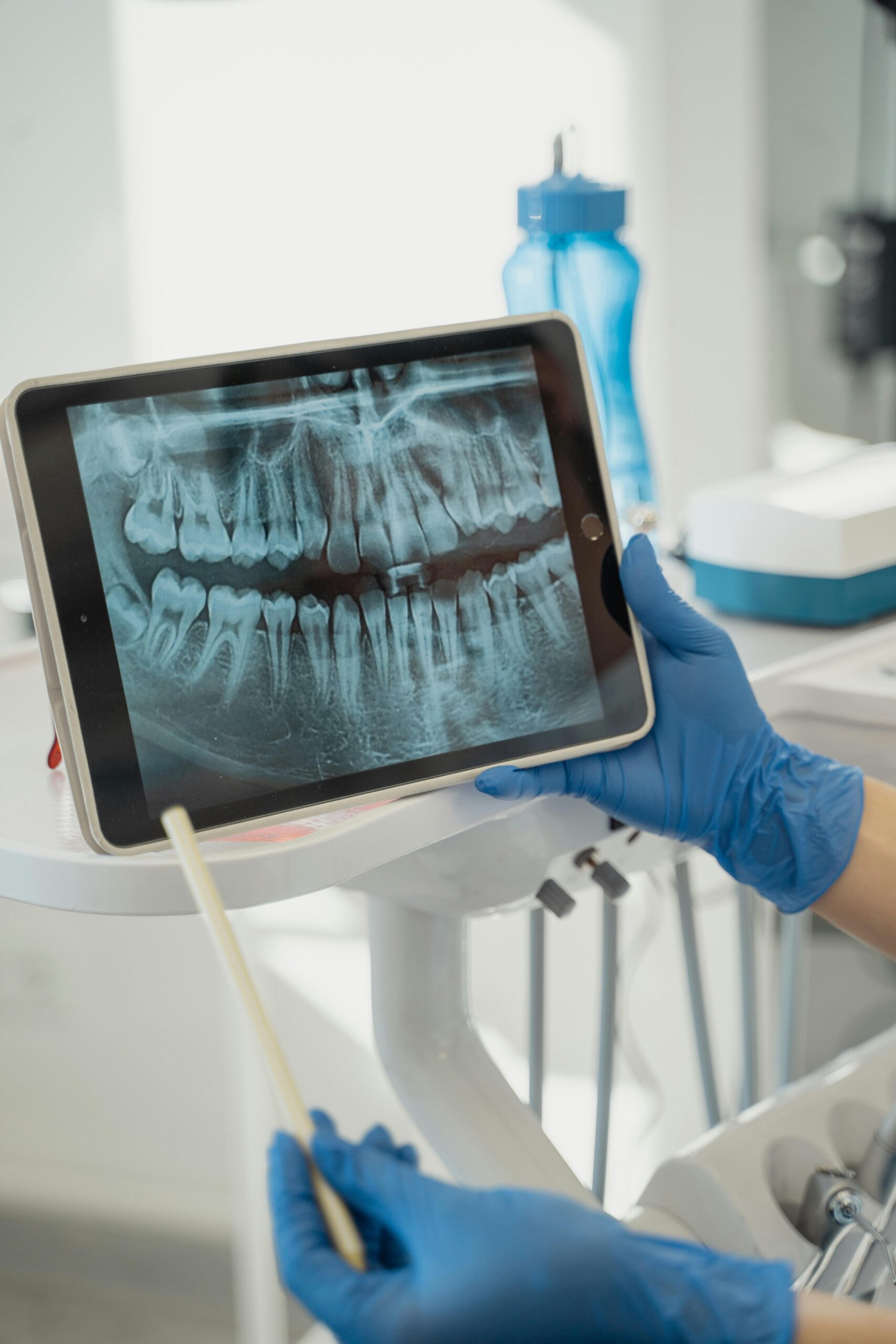 Preparing for Your CBCT Test A Step-by-Step Guide 