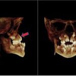 Revenue and Market Trends: What's Driving the CBCT Dental Imaging Sector