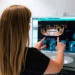Why CBCT Has Become the Gold Standard for Implant Planning 