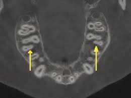 Why Every Dentist is Talking About What is a CBCT in Dentistry