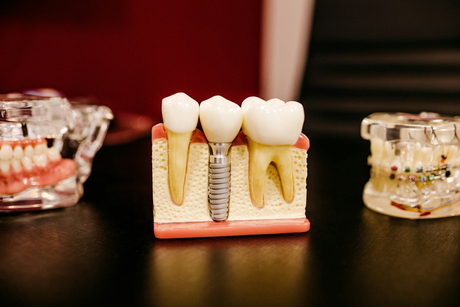 Understanding Dental Implant CBCT: A Primer